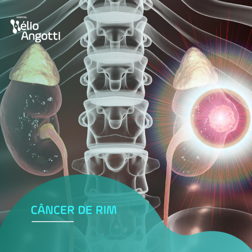 MÊS DE CONSCIENTIZAÇÃO DO CÂNCER DE RIM