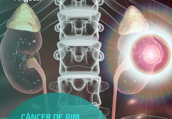 MÊS DE CONSCIENTIZAÇÃO DO CÂNCER DE RIM